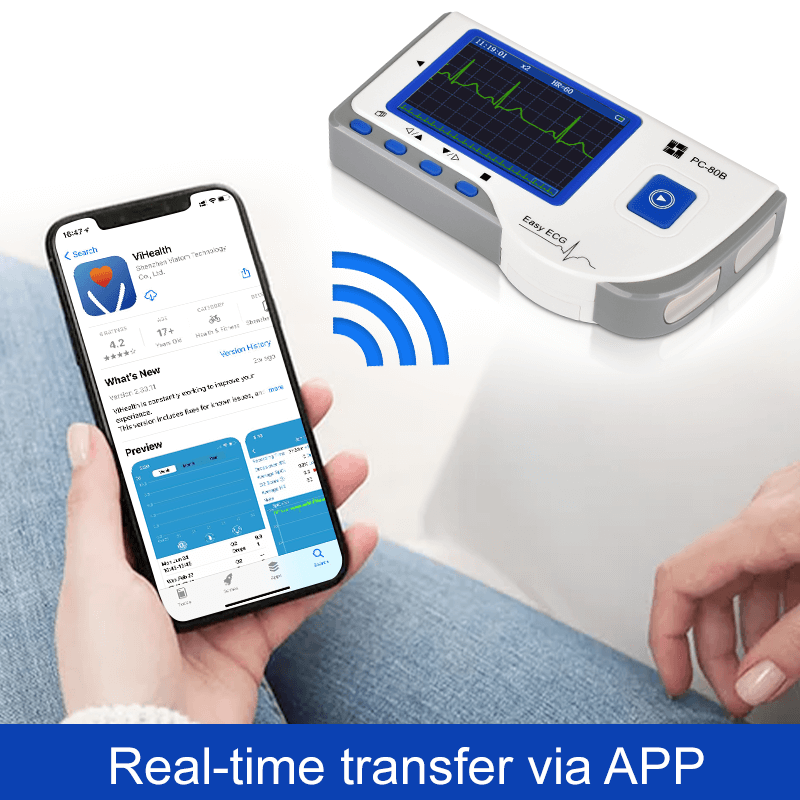 Lepu Easy ECG Monitor Portable EKG Machine Handheld Heart Rate Monitor ECG Sensor PC-80B for Android iPhone Daily Home Use