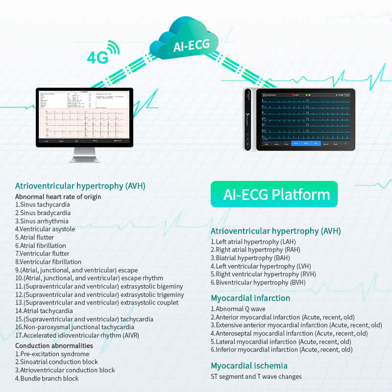 Lepu Medical Ai Analysis Diagnostic Smart 12 Lead ECG Monitor Tablet S120 Touch Screen with WiFi Wireless Transmission