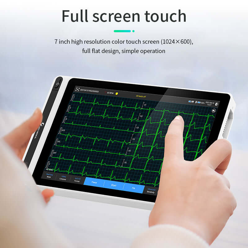 Lepu Medical Ai Analysis Diagnostic Smart 12 Lead ECG Monitor Tablet S120 Touch Screen with WiFi Wireless Transmission