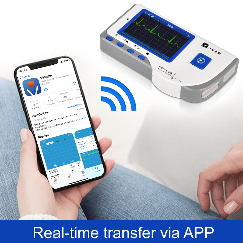 Lepu Medical Grade Heart Monitor Cardiac Monitor Personal Mini EKG Machine  Easy ECG Monitor PC80B for Android iPhone Home Use with Wireless Bluetooth  Connection 3 Lead ECG Cable