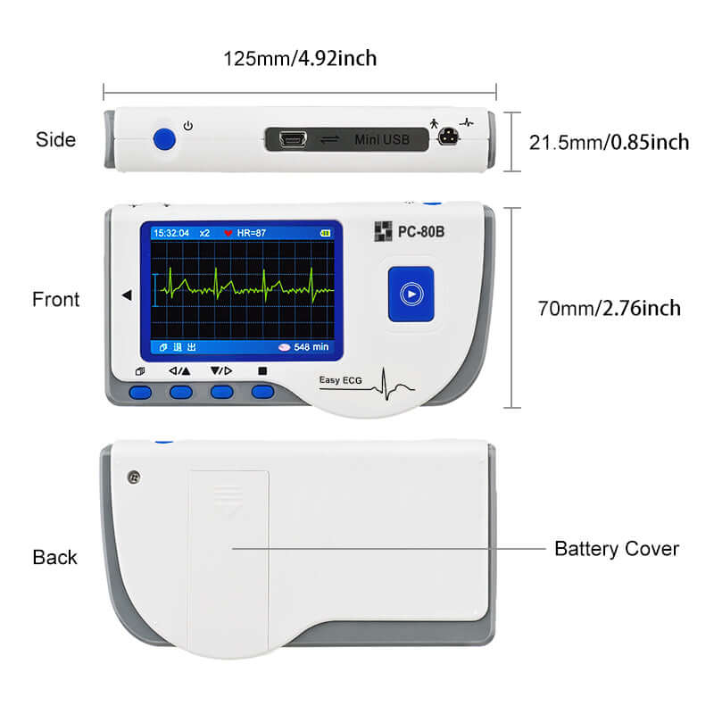 Electrocardiografo Monitor Electrocardiograma Ecg Portatil